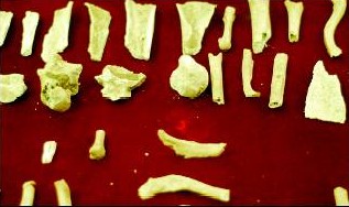 Bones in the San Thome Bishop's Museum